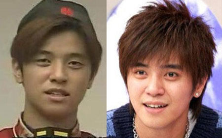 show luo double eyelid surgery