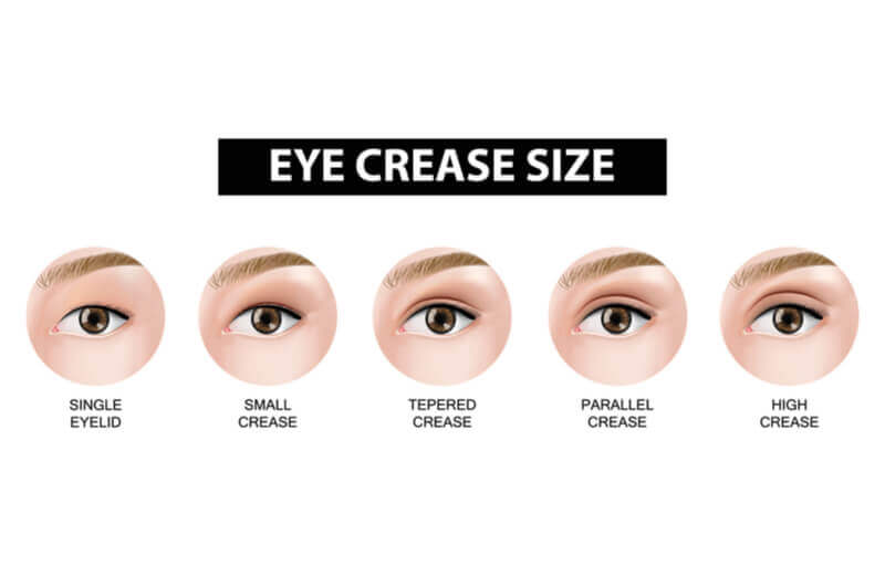 double eyelid crease size diagram